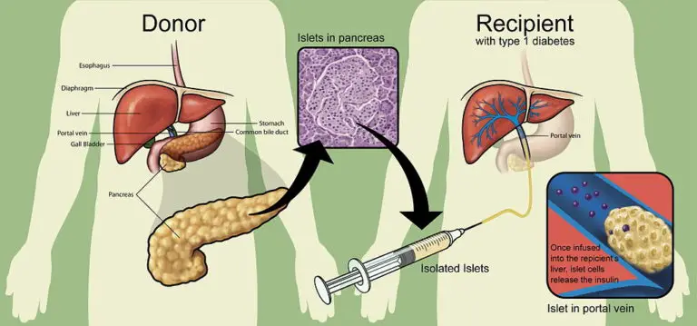 Kidney 